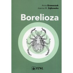 BORELIOZA. ANNA GRZESZCZUK, JOANNA M. ZAJKOWSKA.